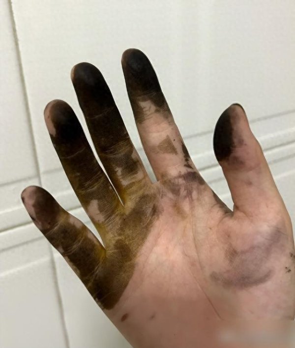 牛在线 今天才知道！做这6件事前一定戴手套，小心害了自己和家人